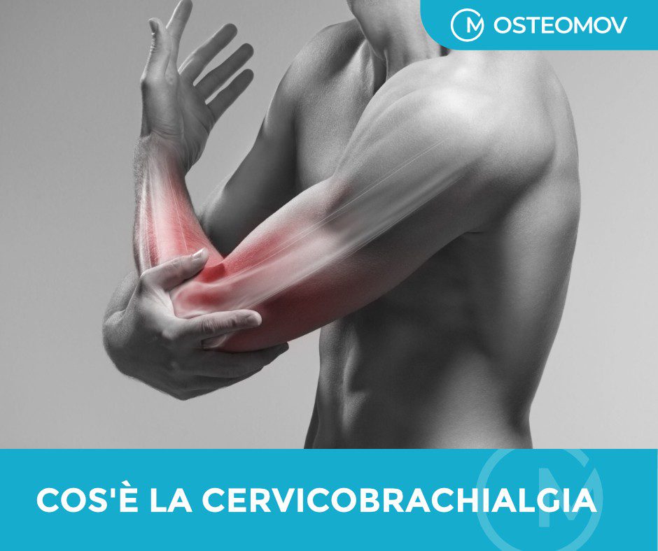 cervicobrachialgia