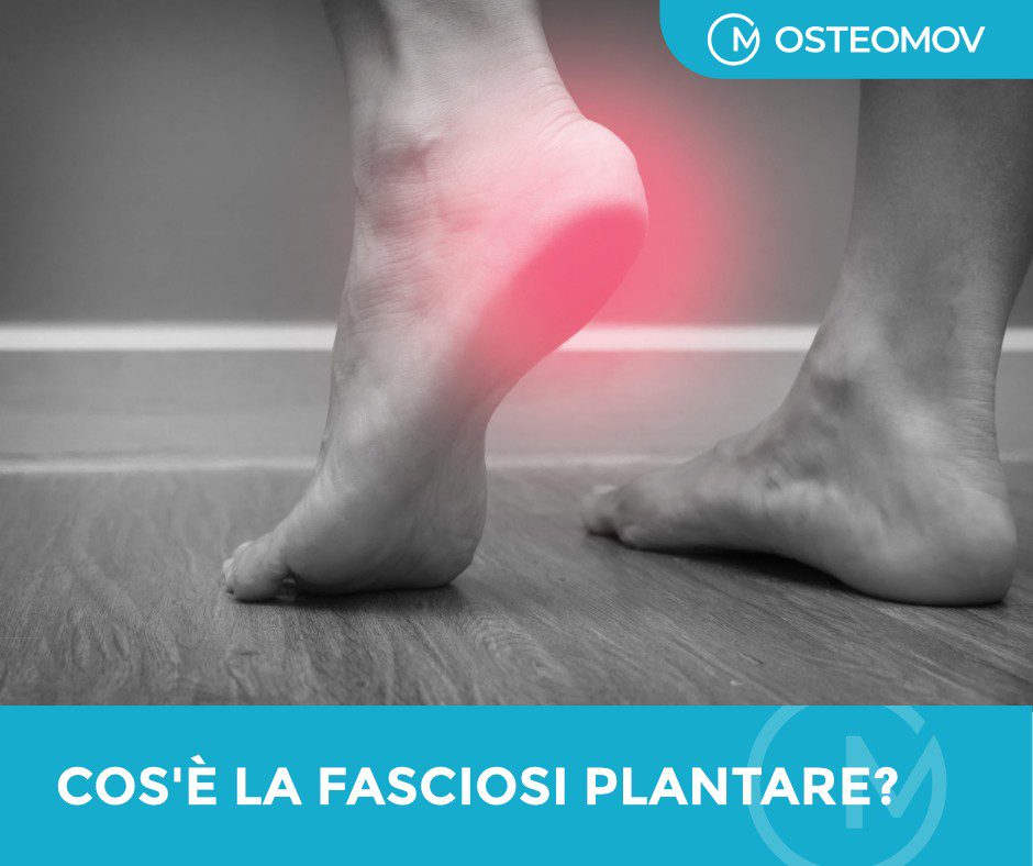 fasciosi plantare