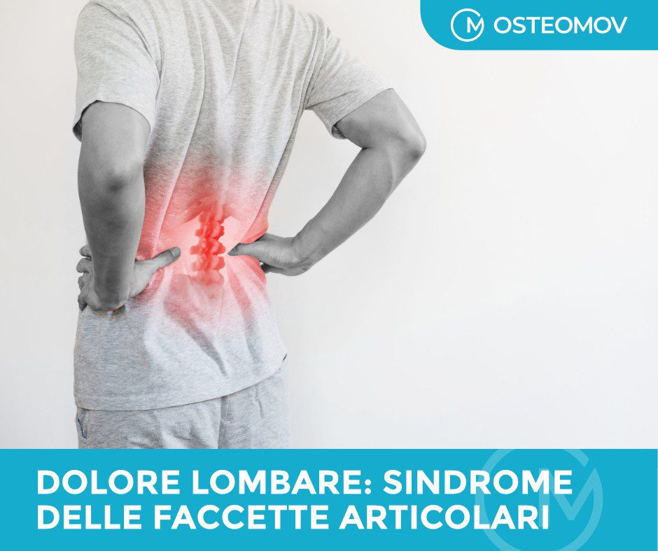 sindrome delle faccette articolari