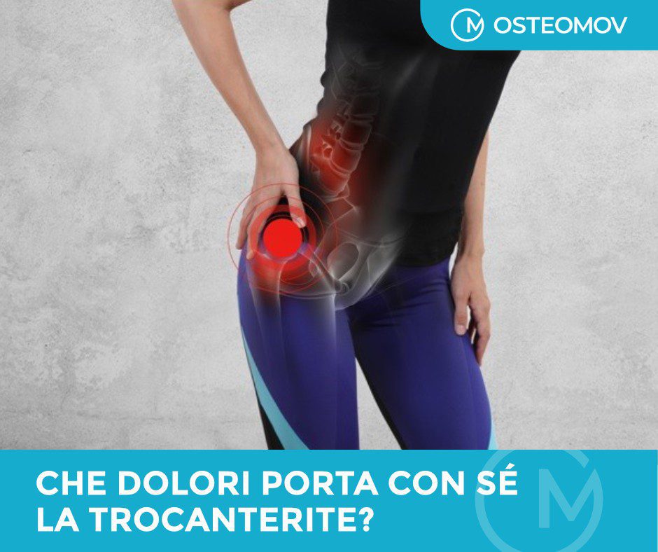 Borsite trocanterica
