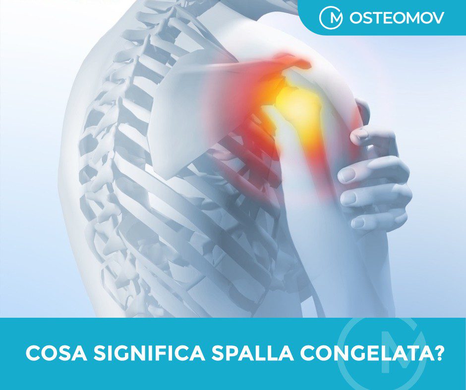Spalla congelata